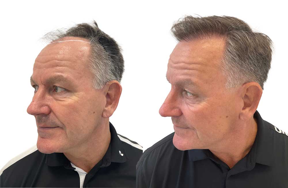 Rene efter 10 månader